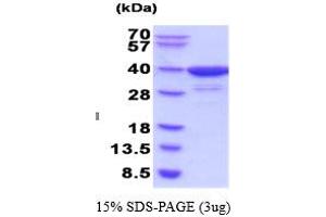 SDS-PAGE (SDS) image for Aldo-keto Reductase Family 1 Member C4 (AKR1C4) (AA 1-323) (Active) protein (ABIN6387734) (AKR1C4 Protein (AA 1-323))