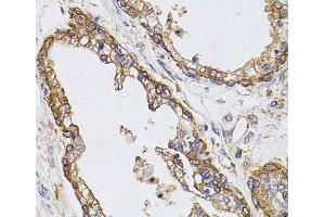 Immunohistochemistry of paraffin-embedded Human prostate using CAST Polyclonal Antibody at dilution of 1:100 (40x lens). (Calpastatin anticorps)