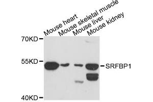 Western blot analysis of extracts of various cell lines, using SRFBP1 antibody. (SRFBP1 anticorps)