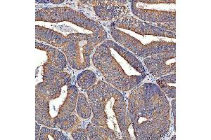 IHC analysis of TTLL2 using anti-TTLL2 antibody (ABIN7600850).