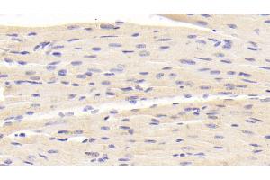 Detection of BACE2 in Mouse Cardiac Muscle Tissue using Polyclonal Antibody to Beta Secretase 2 (BACE2)