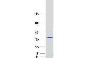 Validation with Western Blot