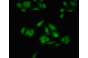 anti-Meis Homeobox 2 (MEIS2) (AA 377-470) antibody