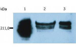 Western Blotting analysis of whole cell lysate of HUT-78 human cutaneous T cell lymphoma cell line. (CD45RA anticorps  (Biotin))