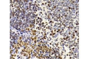 Immunohistochemistry of paraffin-embedded Rat spleen using HIRIP3 Polyclonal Antibody at dilution of 1:100 (40x lens).