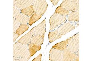Immunohistochemistry of paraffin embedded rat skeletal muscle using ATP2A2 (ABIN7075545) at dilution of 1: 500 (400x lens) (SERCA2 ATPase anticorps)