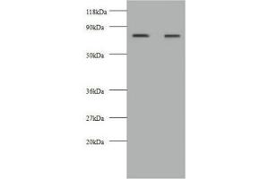 Western blot All lanes: KNG1 antibody at 2 μg/mL Lane 1: HepG2 whole cell lysate Lane 2: 293T whole cell lysate Secondary Goat polyclonal to rabbit IgG at 1/10000 dilution Predicted band size: 72, 48, 44 kDa Observed band size: 72 kDa (KNG1 anticorps  (AA 390-644))