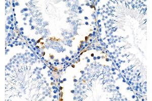ABIN6266183 and ABIN6277404 at 1/100 staining Rat testis tissue by IHC-P.
