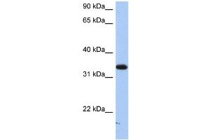 WB Suggested Anti-SULT6B1 Antibody Titration:  0.