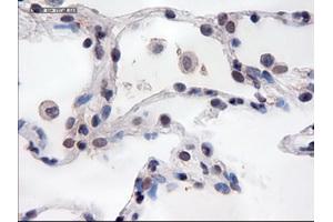 Immunohistochemical staining of paraffin-embedded lung using anti-PECAM1 (TA000121) mouse monoclonal antibody. (CD31 anticorps  (AA 425-591))