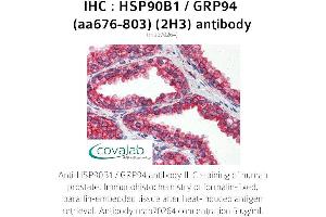 Image no. 2 for anti-Heat Shock Protein 90kDa beta (Grp94), Member 1 (HSP90B1) (AA 676-803) antibody (ABIN1723190)