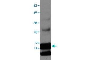 Western blot on ENHO overexpression lysate with ENHO polyclonal antibody . (ENHO anticorps  (AA 10-60))