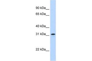 Western Blotting (WB) image for anti-MKI67 FHA Domain-Interacting Nucleolar Phosphoprotein (MKI67IP) antibody (ABIN2462317) (NIFK anticorps)