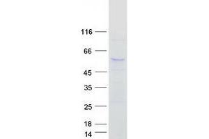 Validation with Western Blot