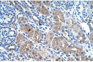 Rabbit Anti-FBP1 Antibody  Paraffin Embedded Tissue: Human Kidney Cellular Data: Epithelial cells of renal tubule Antibody Concentration: 4. (FBP1 anticorps  (N-Term))