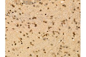 Phospho-c-Fos (Thr232) Antibody at 1/100 staining Mouse brain tissue by IHC-P.