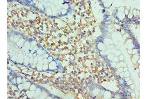 Immunohistochemistry of paraffin-embedded human small intestine tissue using ABIN7151389 at dilution of 1:100
