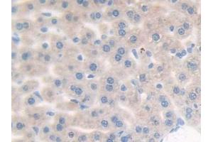 DAB staining on IHC-P; Samples: Mouse Liver Tissue (Complement Factor B anticorps  (AA 474-590))