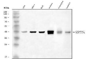 Western blot analysis of LARP/SEPTIN1 using anti-LARP/SEPTIN1 antibody (ABIN7602899).
