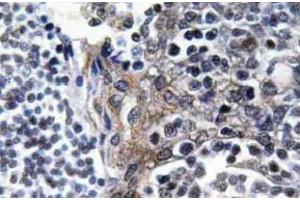 Immunohistochemistry (IHC) analyzes of VASP antibody in paraffin-embedded human tonsil tissue. (VASP anticorps  (pSer157))