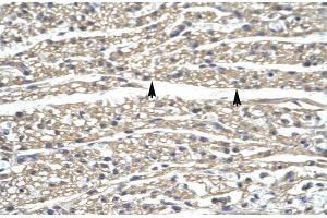 Human Heart; ZNF336 antibody - N-terminal region in Human Heart cells using Immunohistochemistry (ZNF336 anticorps  (N-Term))
