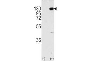 Western blot analysis of FGFR1 antibody and 293 cell lysate (2 ug/lane) either nontransfected (Lane 1) or transiently transfected with the FGFR1 gene (2).