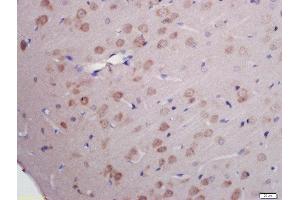 Formalin-fixed and paraffin embedded rat brain labeled with Rabbit Anti-RNA polymerase II CTD repeat YSPTSPS (Ser2) Polyclonal Antibody, Unconjugated (ABIN718391) at 1:200 followed by conjugation to the secondary antibody and DAB staining (RNA Polymerase 2 (pSer2) anticorps)