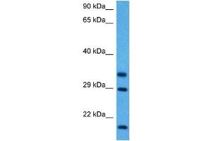 Host:  Mouse  Target Name:  FHL1  Sample Tissue:  Mouse Skeletal Muscle  Antibody Dilution:  1ug/ml (FHL1 anticorps  (C-Term))