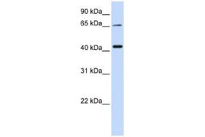 WB Suggested Anti-QPCTL Antibody Titration:  0. (QPCTL anticorps  (Middle Region))