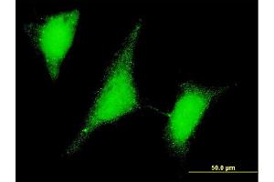 Immunofluorescence of monoclonal antibody to UBE2W on HeLa cell.