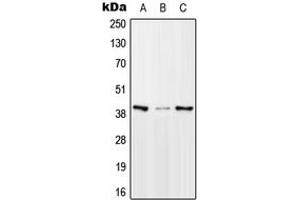 Western blot analysis of mTERF expression in HeLa (A), Raw264. (MTERF anticorps  (Center))
