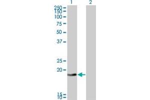 anti-DCMP Deaminase (DCTD) (AA 69-179) antibody