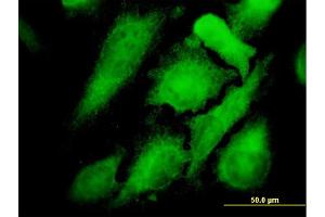 Immunofluorescence of monoclonal antibody to MAPK12 on HeLa cell. (MAPK12 anticorps  (AA 251-367))