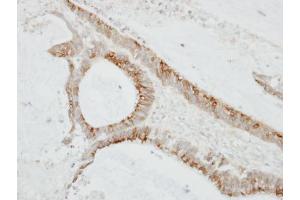 IHC-P Image Immunohistochemical analysis of paraffin-embedded TW2.