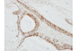 IHC-P Image Immunohistochemical analysis of paraffin-embedded TW2. (CMTM6 anticorps  (C-Term))