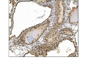 IHC analysis of AS160/TBC1D4 using anti-AS160/TBC1D4 antibody (ABIN7599745). (TBC1D4 anticorps  (AA 1118-1298))