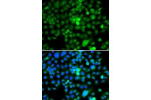 Immunofluorescence analysis of A549 cells using NAP1L3 antibody (ABIN5974335). (NAP1L3 anticorps)