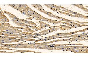 Detection of RIPK1 in Mouse Cardiac Muscle Tissue using Polyclonal Antibody to Receptor Interacting Serine Threonine Kinase 1 (RIPK1)