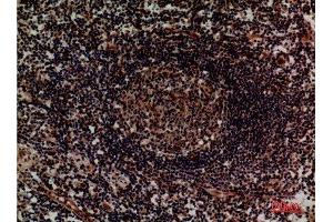 Immunohistochemistry (IHC) analysis of paraffin-embedded Human Lymph, antibody was diluted at 1:100. (ITGA4 anticorps  (Internal Region))