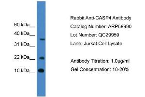 WB Suggested Anti-CASP4  Antibody Titration: 0. (Caspase 4 anticorps  (Middle Region))