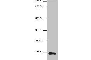 Western blot All lanes: RAB30 antibody at 1 μg/mL + Hela whole cell lysate Secondary Goat polyclonal to rabbit IgG at 1/10000 dilution Predicted band size: 24, 19 kDa Observed band size: 19 kDa (RAB3A anticorps  (AA 1-200))