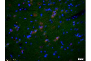 Formalin-fixed and paraffin-embedded rat brain labeled with Anti-GluR1/AMPA Polyclonal Antibody, Unconjugated (ABIN1385842) 1:200, overnight at 4°C, The secondary antibody was Goat Anti-Rabbit IgG, Cy3 conjugated used at 1:200 dilution for 40 minutes at 37°C. (GluR1, GluR2 anticorps  (AA 141-240))