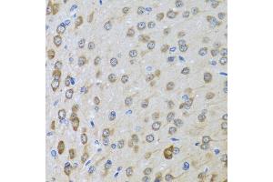 Immunohistochemistry of paraffin-embedded rat brain using BTD antibody (ABIN6127510, ABIN6137680, ABIN6137682 and ABIN6221882) at dilution of 1:100 (40x lens).