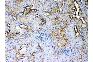 IHC analysis of ALDH1A3 using anti- ALDH1A3 antibody .
