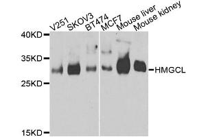 Western blot analysis of extracts of various cell lines, using HMGCL antibody. (HMGCL anticorps)