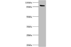 Western blot All lanes: Calpain-3 antibody at 5 μg/mL + Mouse brain tissue Secondary Goat polyclonal to rabbit IgG at 1/10000 dilution Predicted band size: 95, 85, 94, 36, 19 kDa Observed band size: 95 kDa (Calpain 3 anticorps  (AA 582-821))