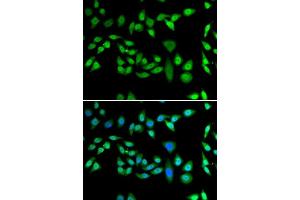 Immunofluorescence analysis of U2OS cells using DNAJB6 antibody.