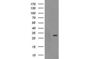 Western Blotting (WB) image for anti-Exosome Component 3 (EXOSC3) antibody (ABIN1498139) (EXOSC3 anticorps)