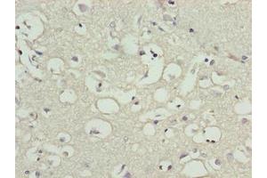 Immunohistochemistry of paraffin-embedded human brain tissue using ABIN7165213 at dilution of 1:100 (CNIH3 anticorps  (AA 94-138))