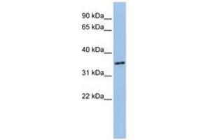 Image no. 1 for anti-PHD Finger Protein 13 (PHF13) (AA 36-85) antibody (ABIN6741099) (PHF13 anticorps  (AA 36-85))